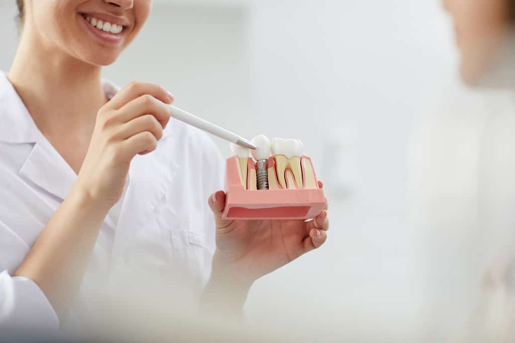 What Are the Different Types of Dental Implants?
