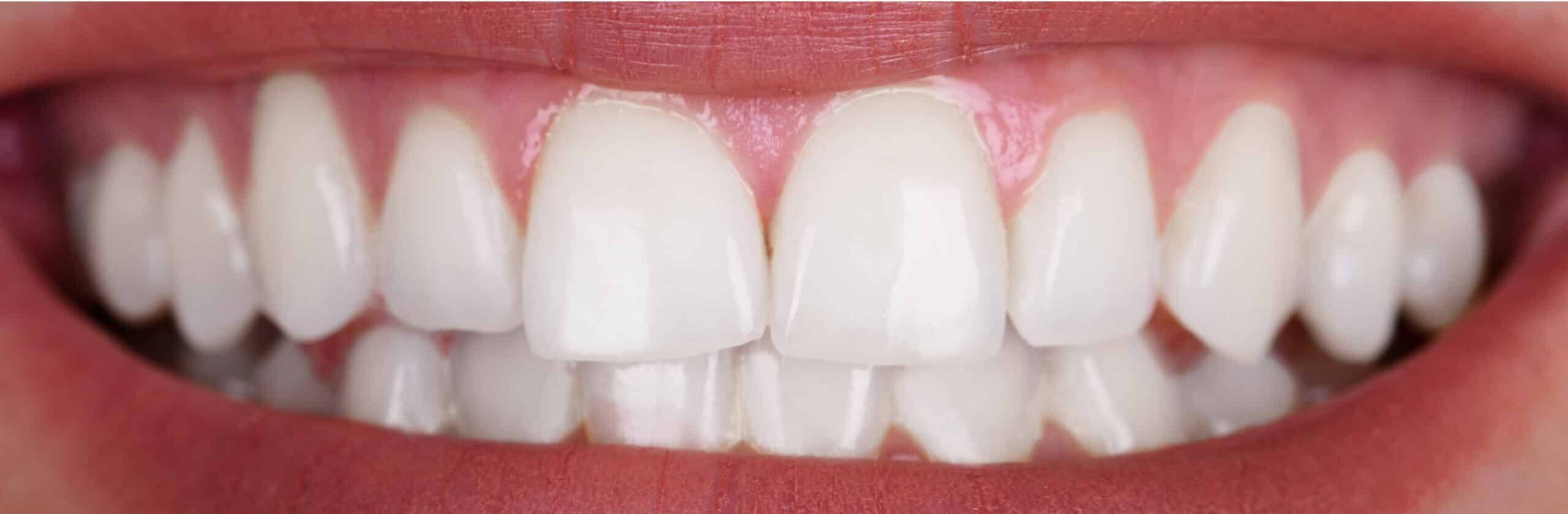 f830436f0f271fd1e84bd95d42c6125f10e605b0 1 scaled e1755003974879 - Northern Westchester Dental Care