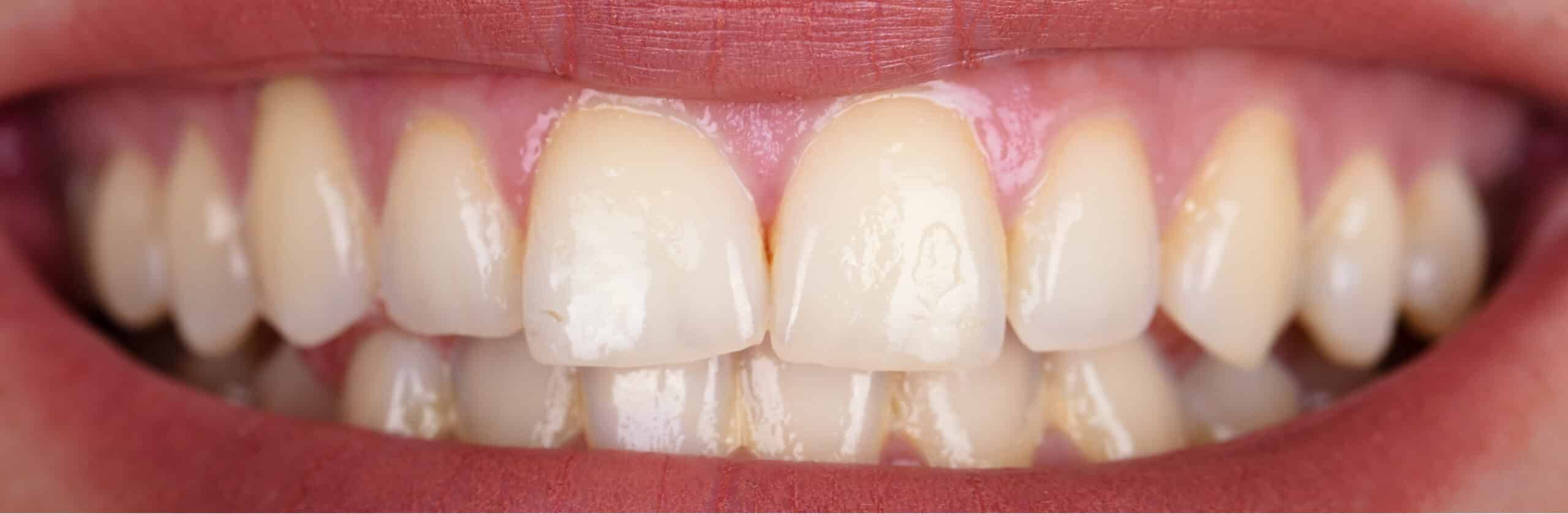 f830436f0f271fd1e84bd95d42c6125f10e605b0 scaled e1755003945197 - Northern Westchester Dental Care