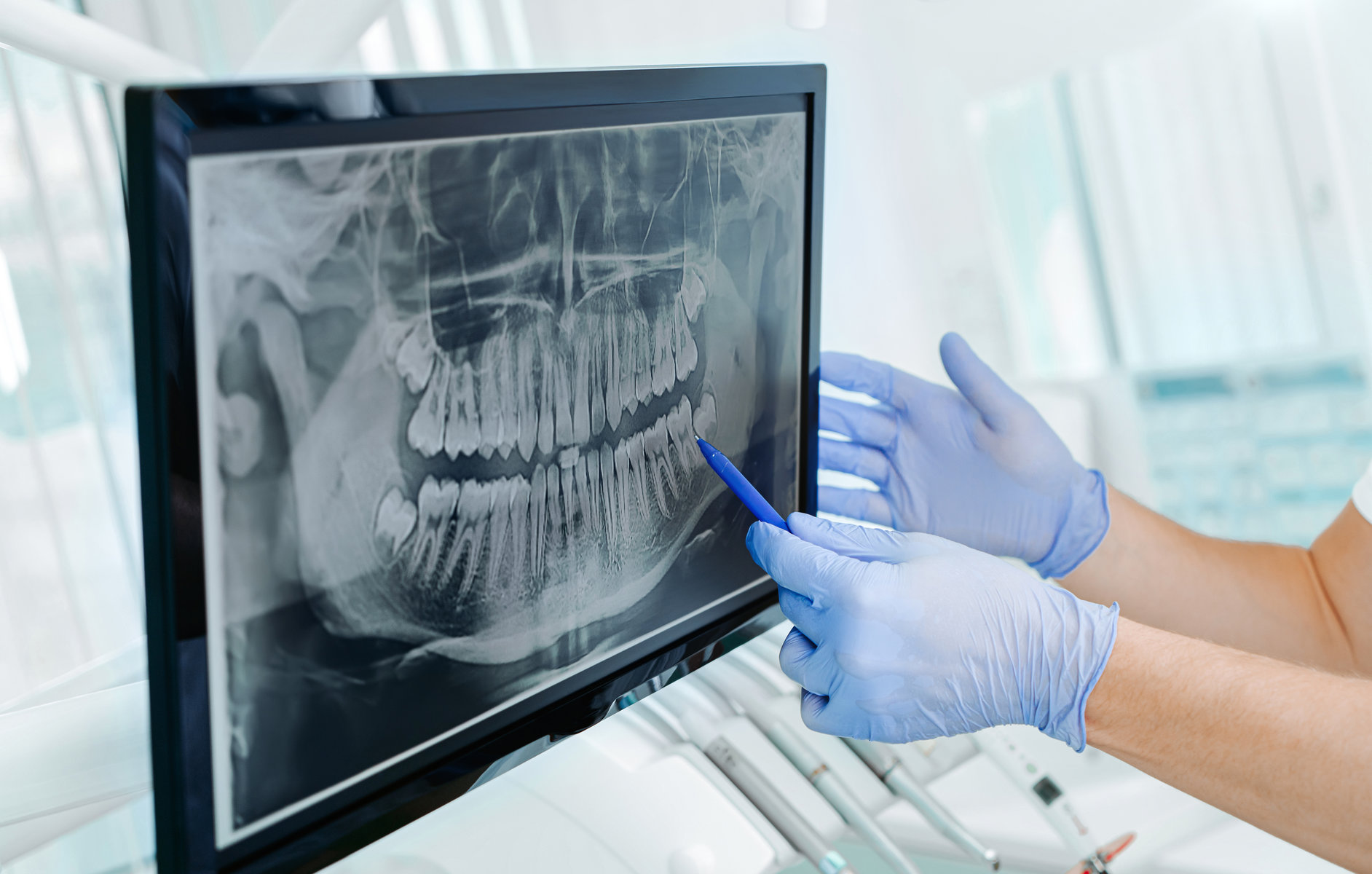 How Modern Technology Has Made Root Canal Therapy More Comfortable