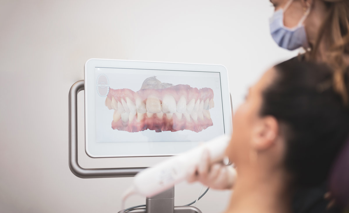 How Do Digital Impressions Improve Accuracy and Comfort in Restorative Dentistry?